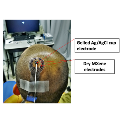 electrodes on head